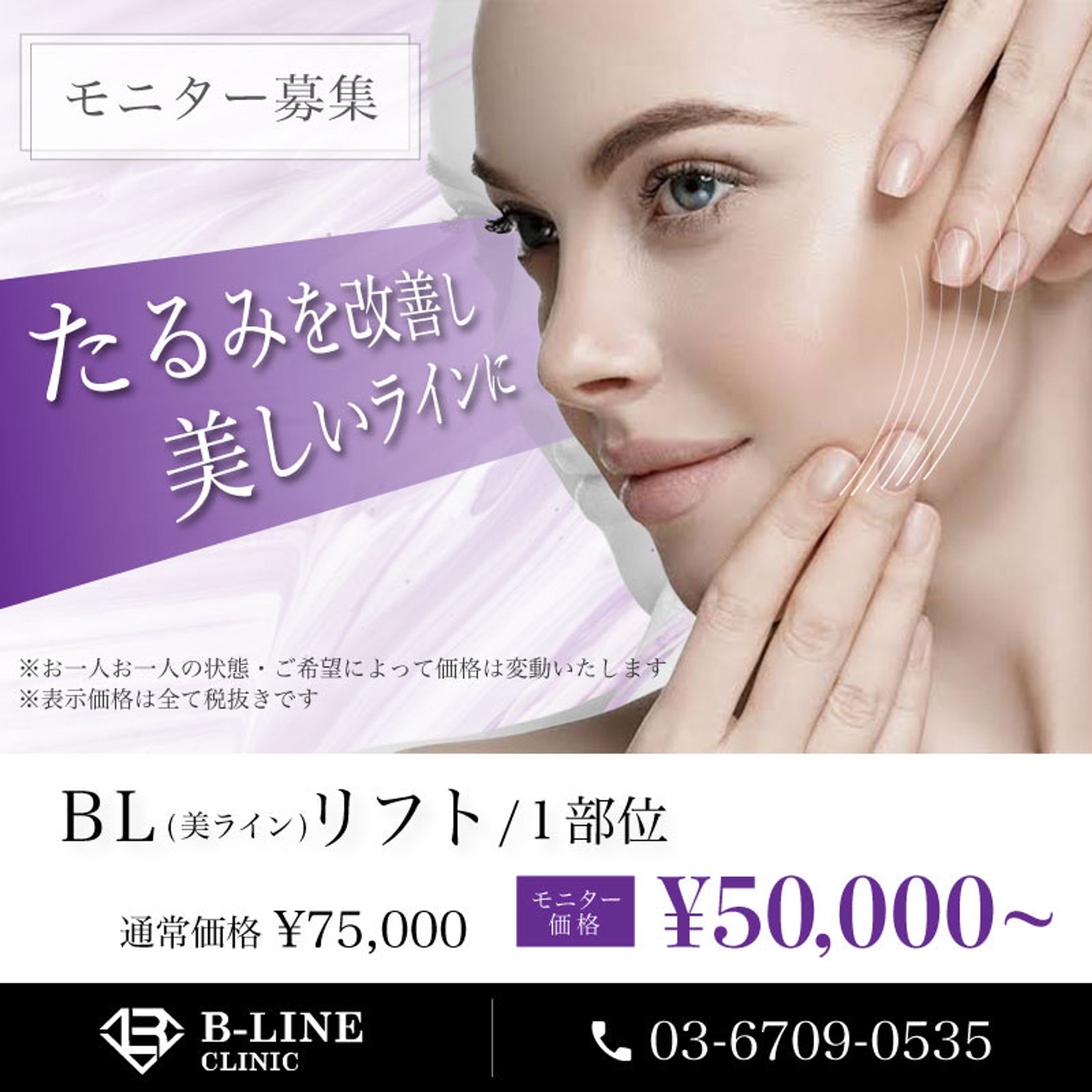 LINEリッチメッセージ-1
