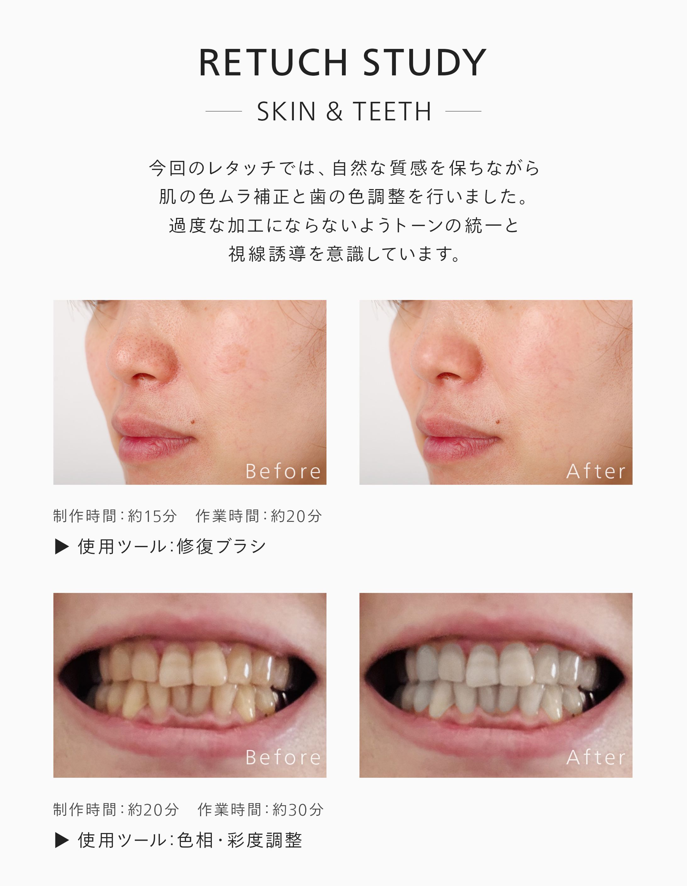 肌と歯のレタッチ-1
