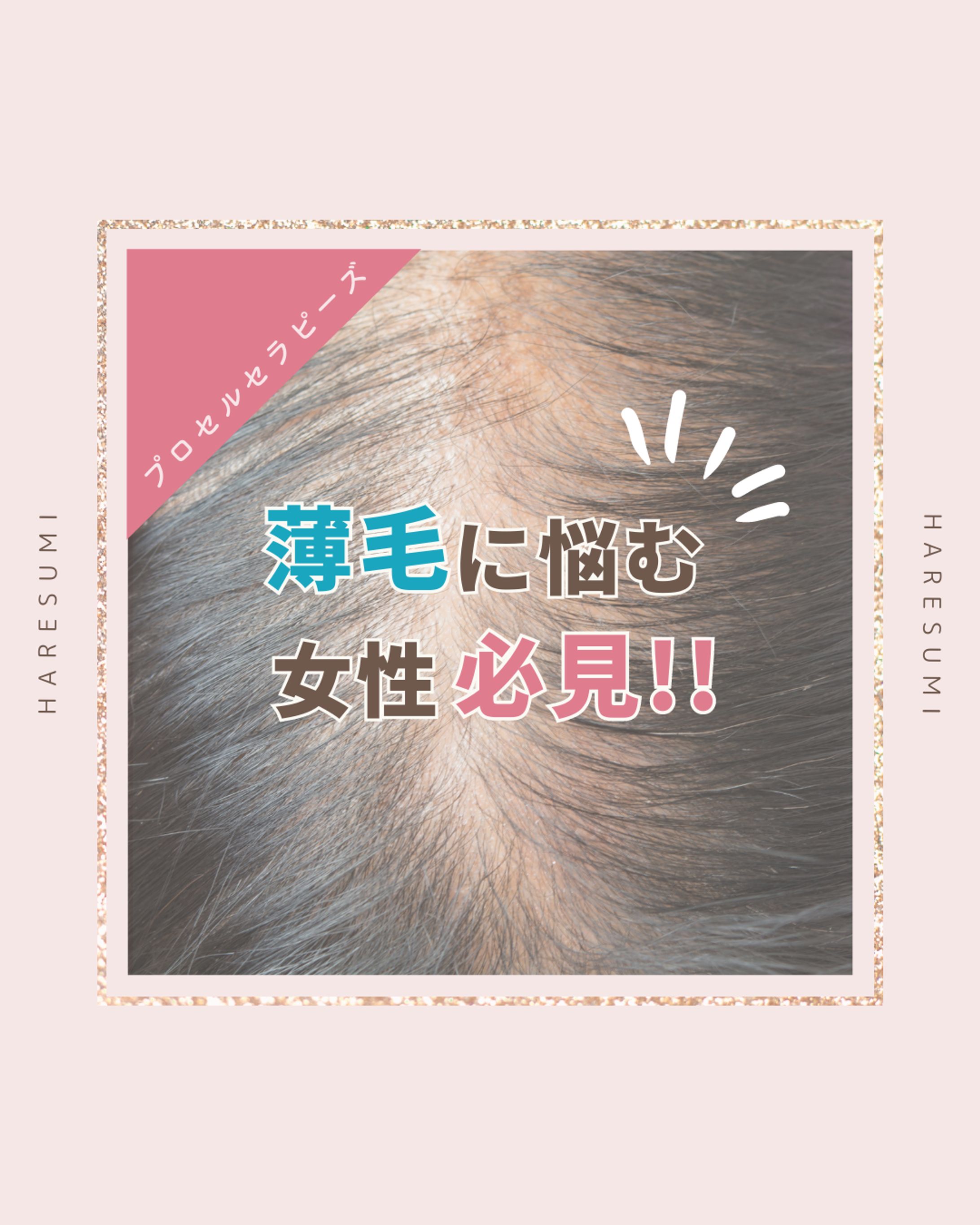 SNSサムネ画像/エステサロン-1