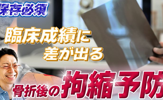 骨折後の拘縮予防
