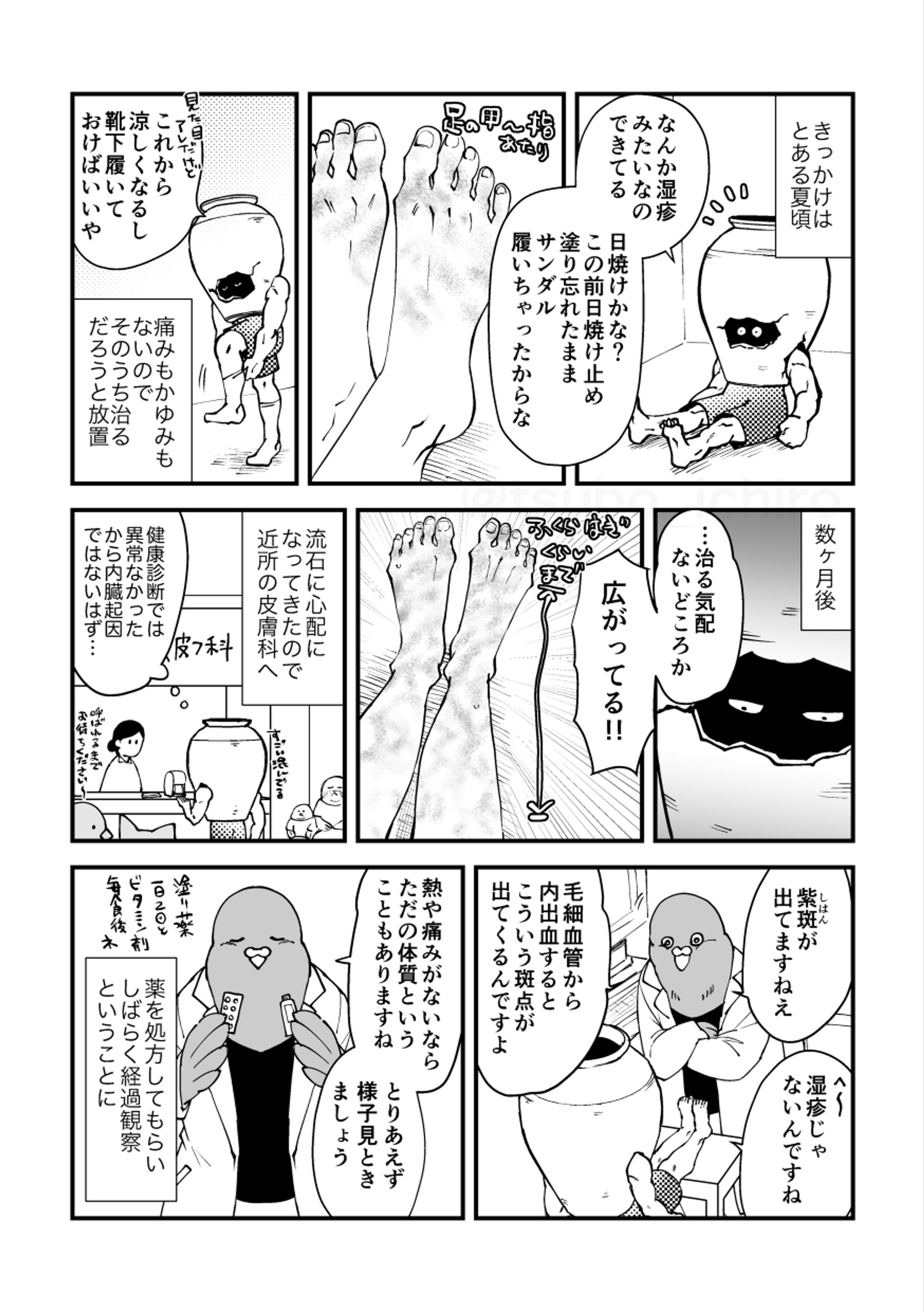 持病についてのエッセイ漫画（4p+おまけ1p）-1