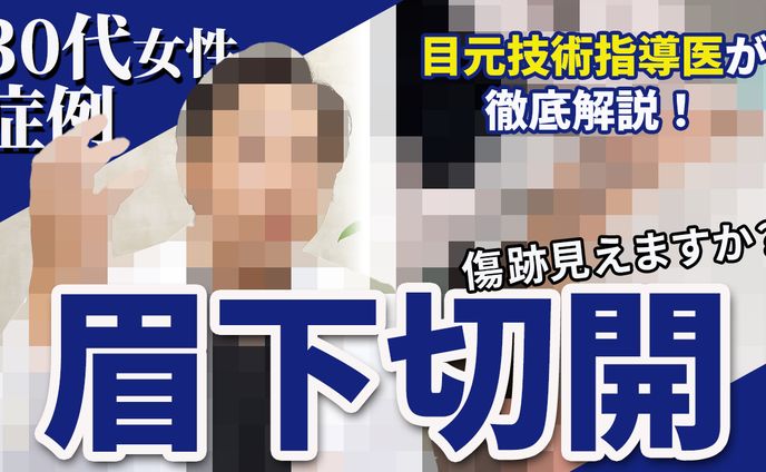 サムネイル14（演者はモザイクかけています）