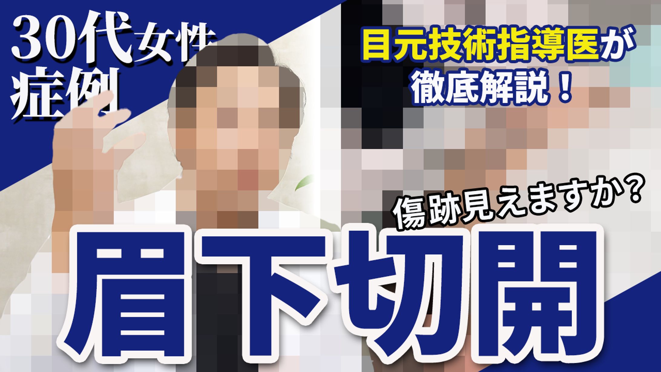 サムネイル14（演者はモザイクかけています）-1