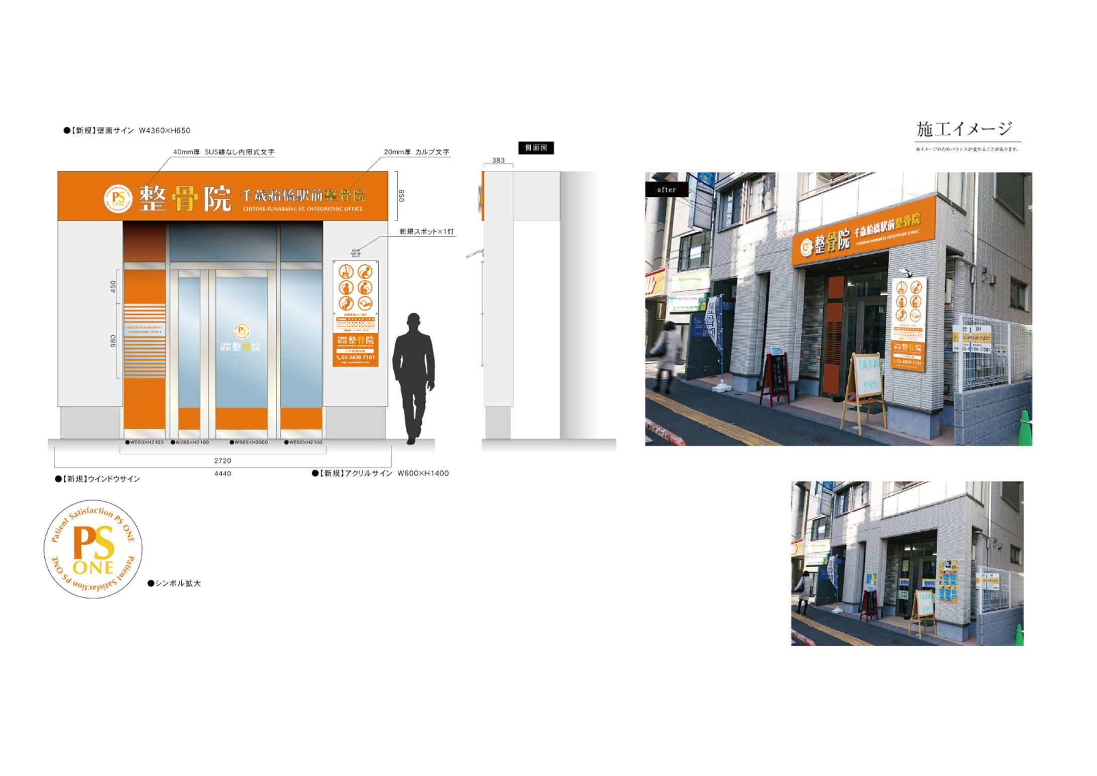 整骨院　店舗サイン-1