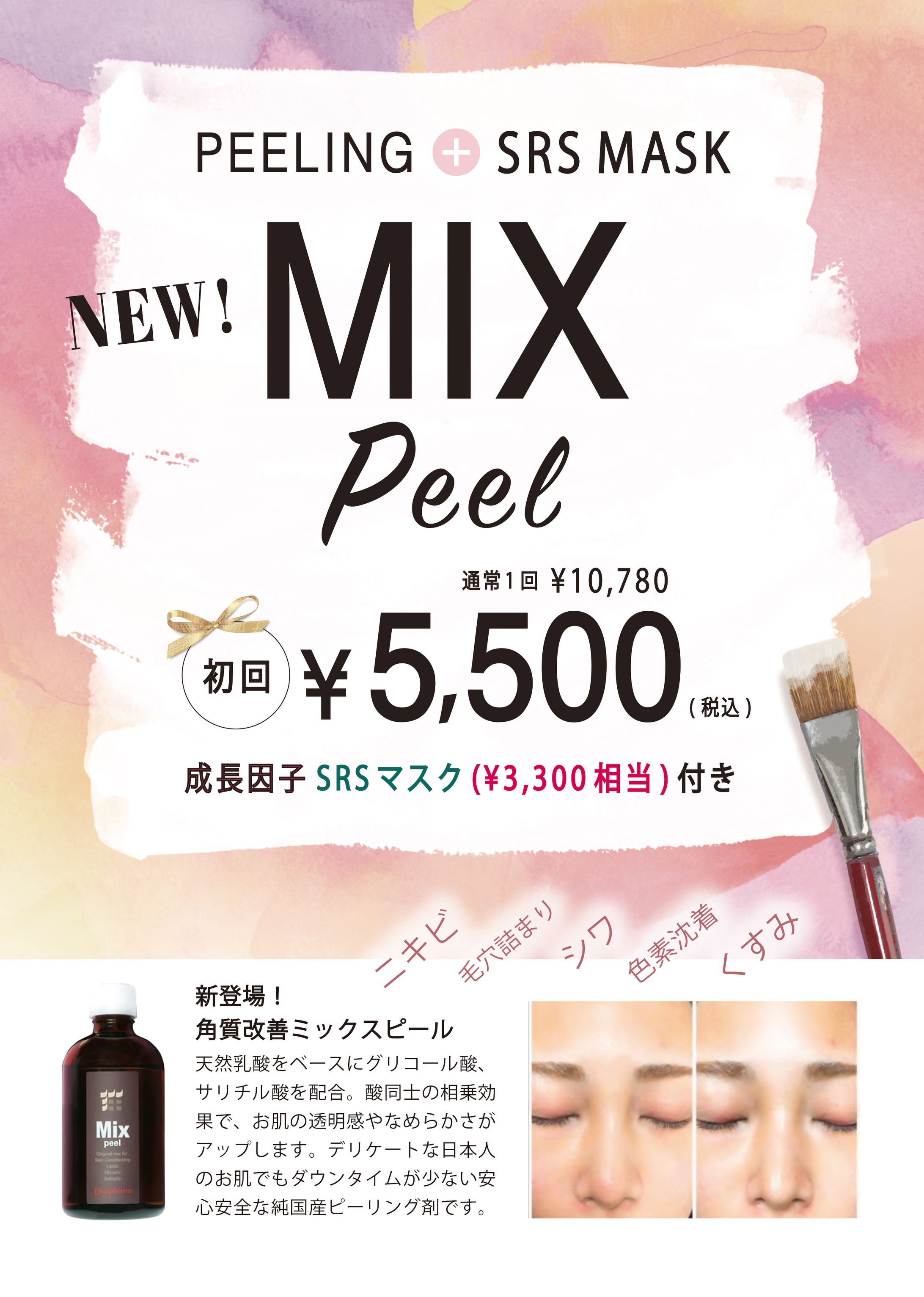 WEB　ピーリング治療-1