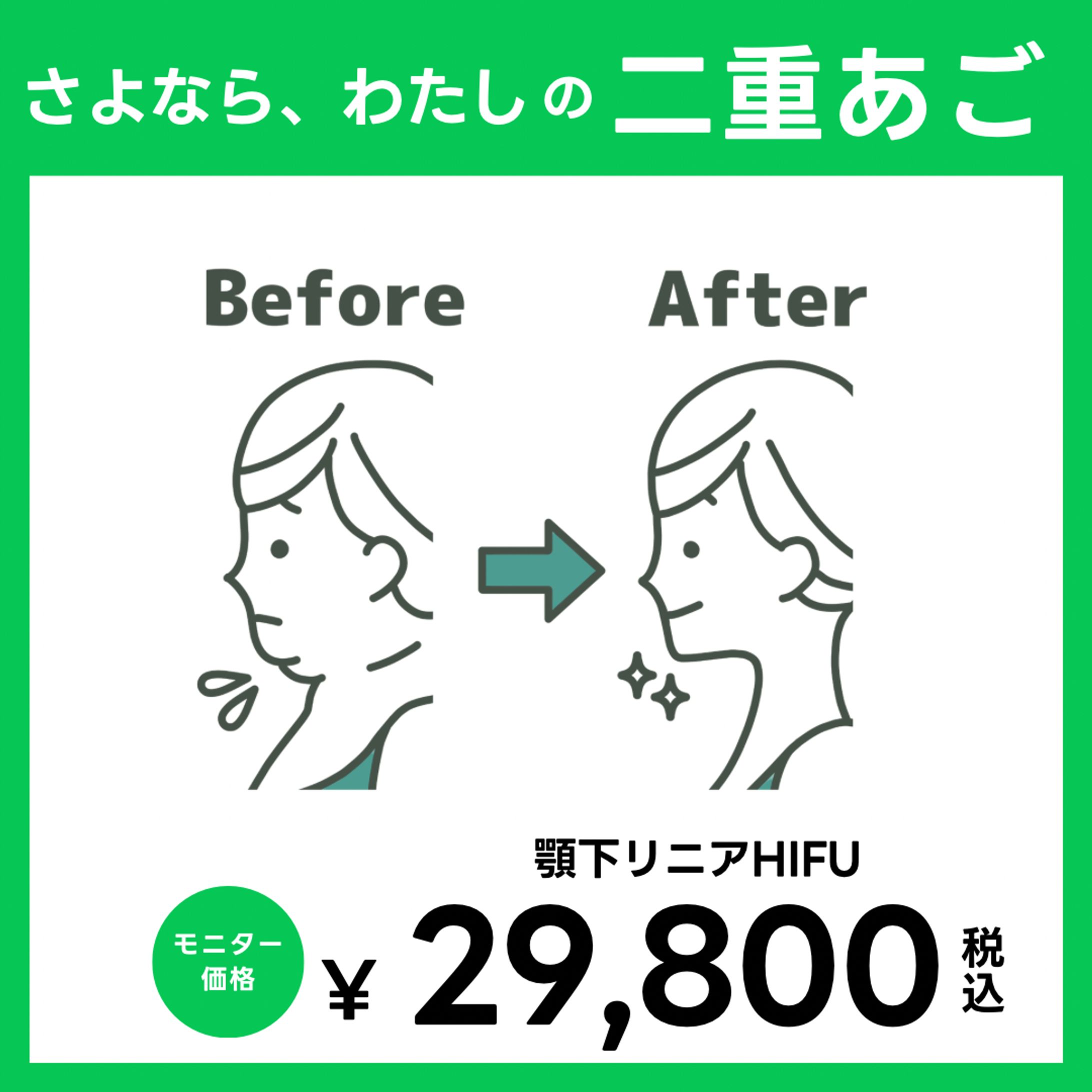 LINE広告バナー-1