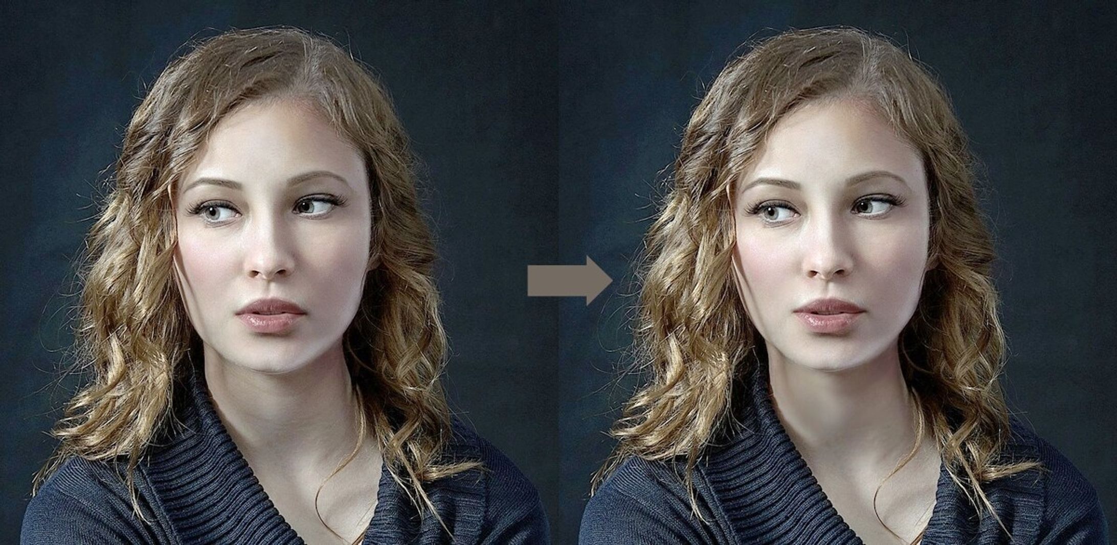 違和感なく顔痩せ・首のシワ、ほうれい線消し-1