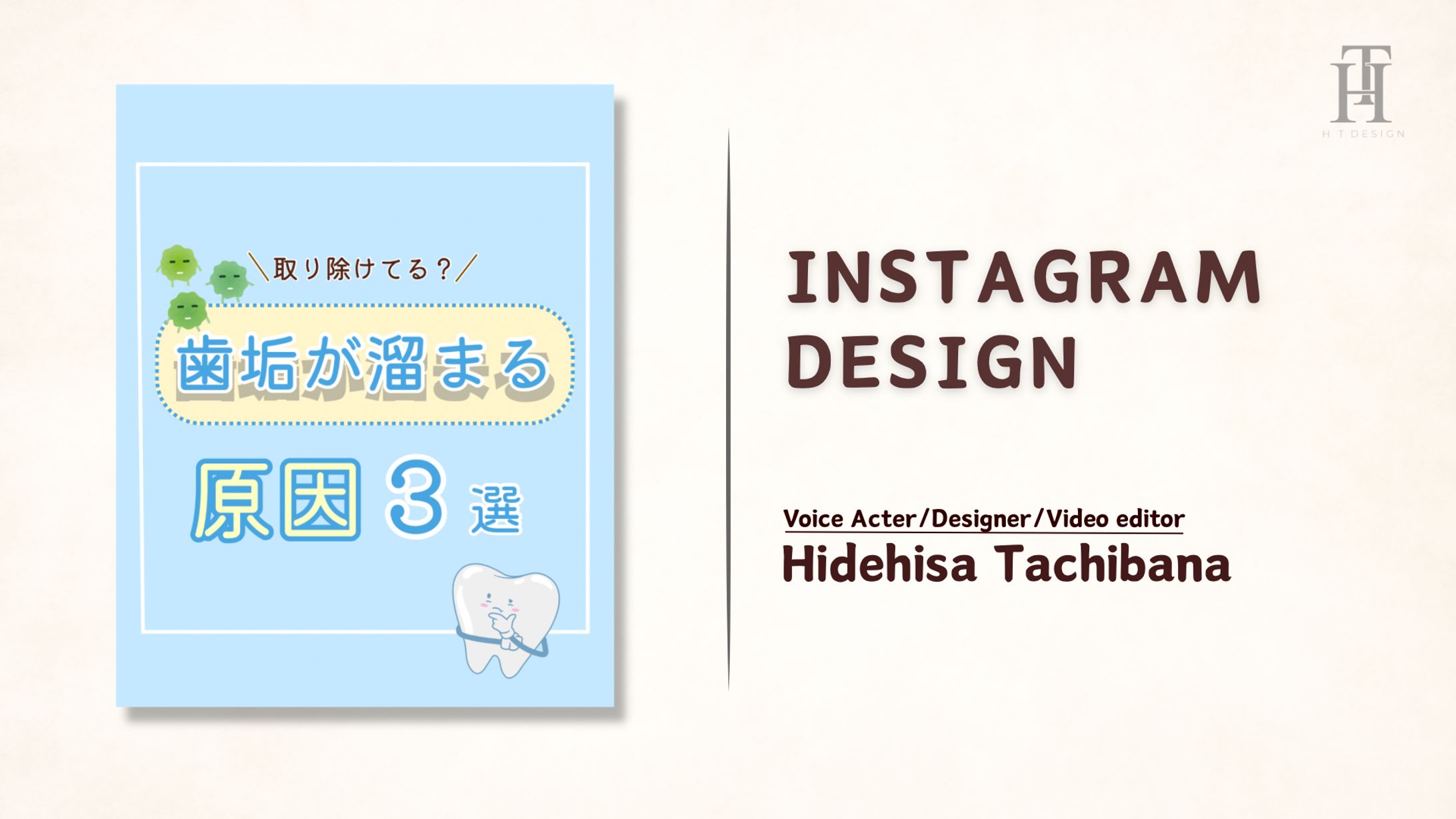 歯垢が溜まる原因3選【クリニック】-1