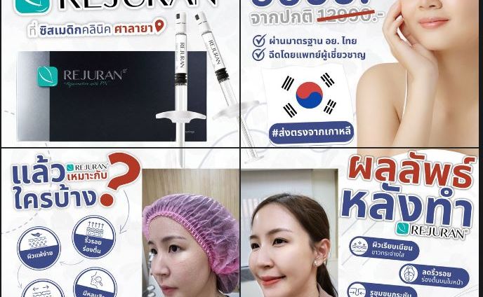 Rejuran 4 Photo Grid Promotion