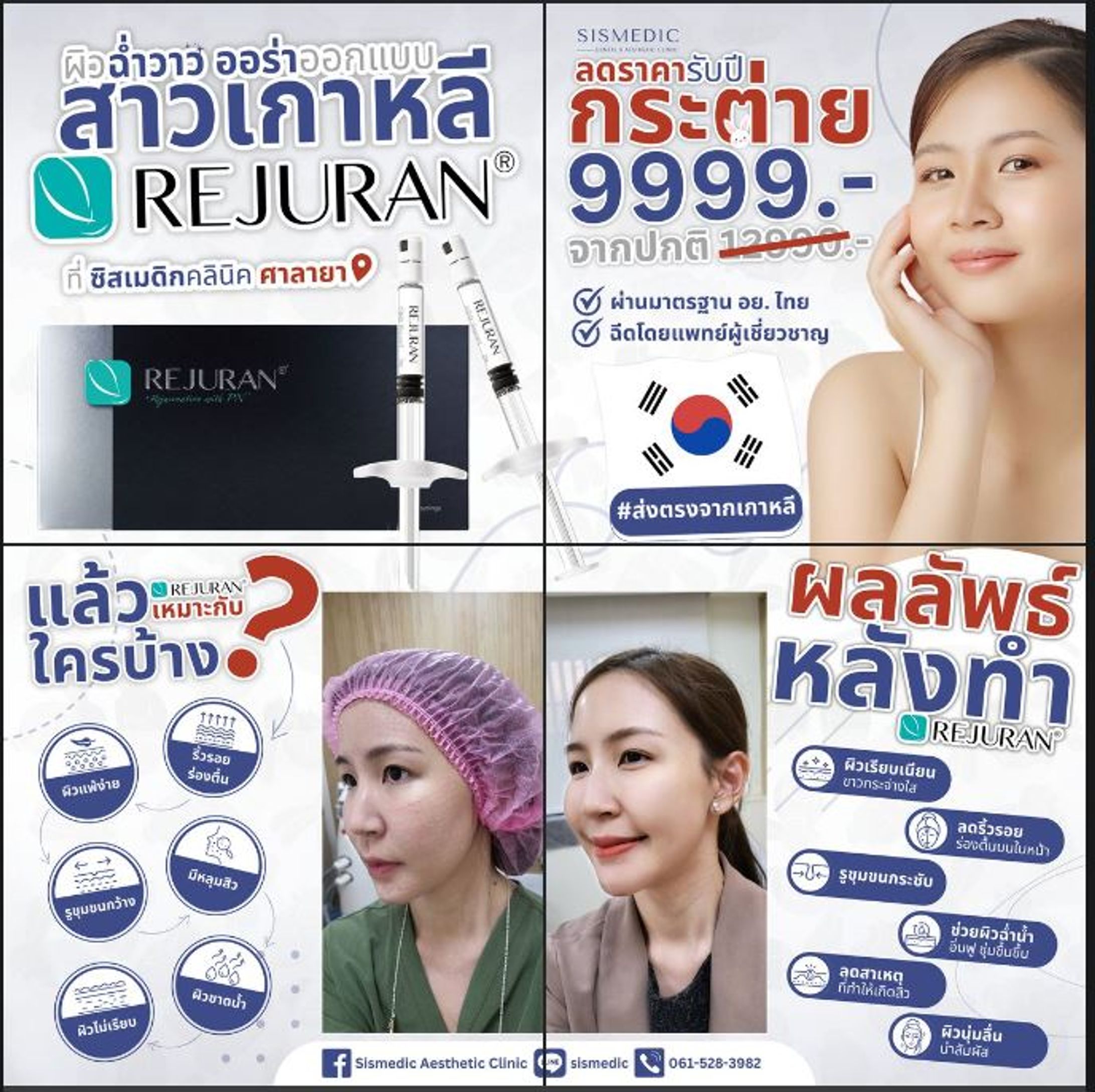 Rejuran 4 Photo Grid Promotion-1