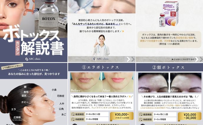 美容クリニック_Instagram投稿サンプル