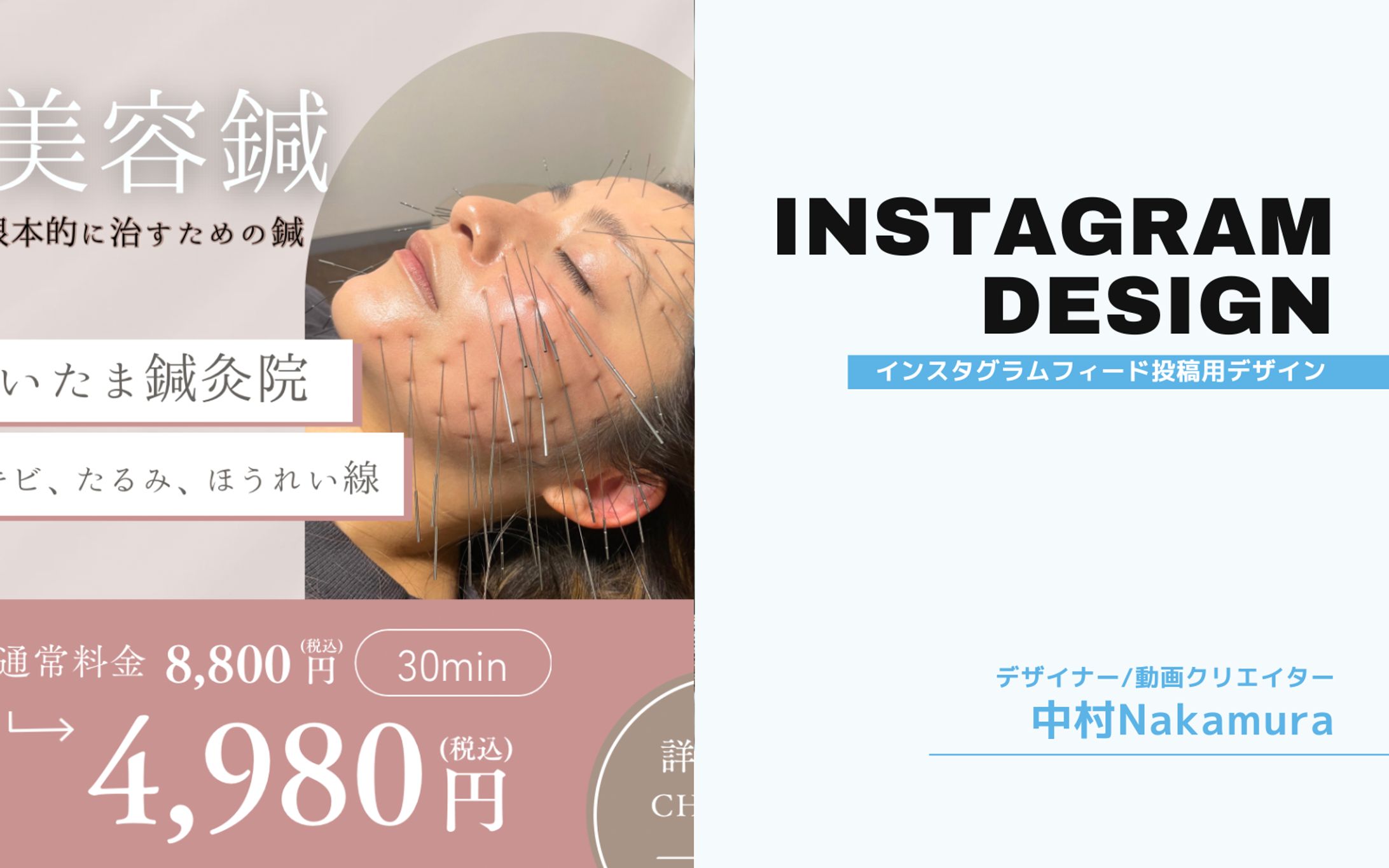 鍼灸院Instagram投稿　チラシ-1