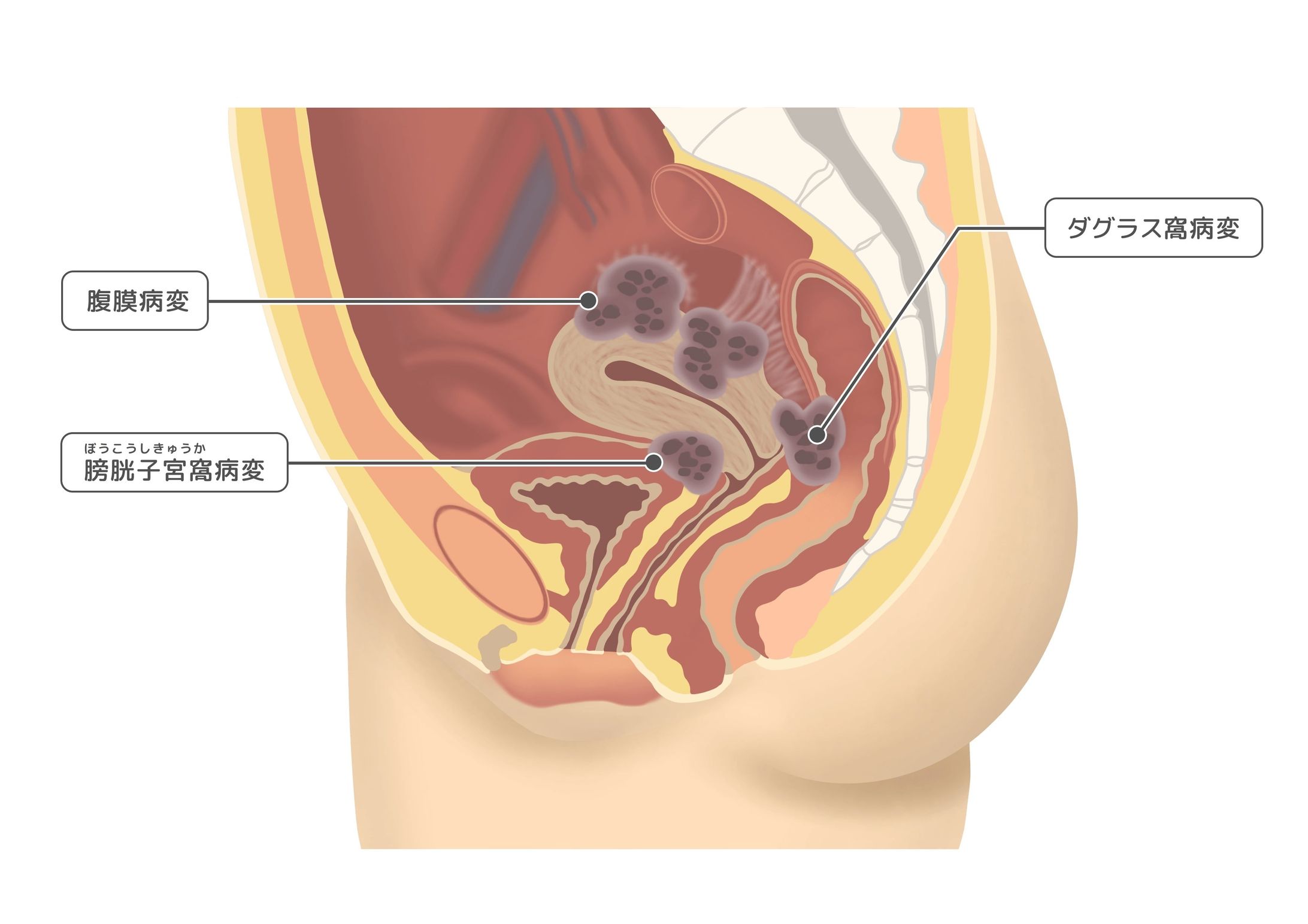 医療イラスト（レディスクリニック様／2024）-1