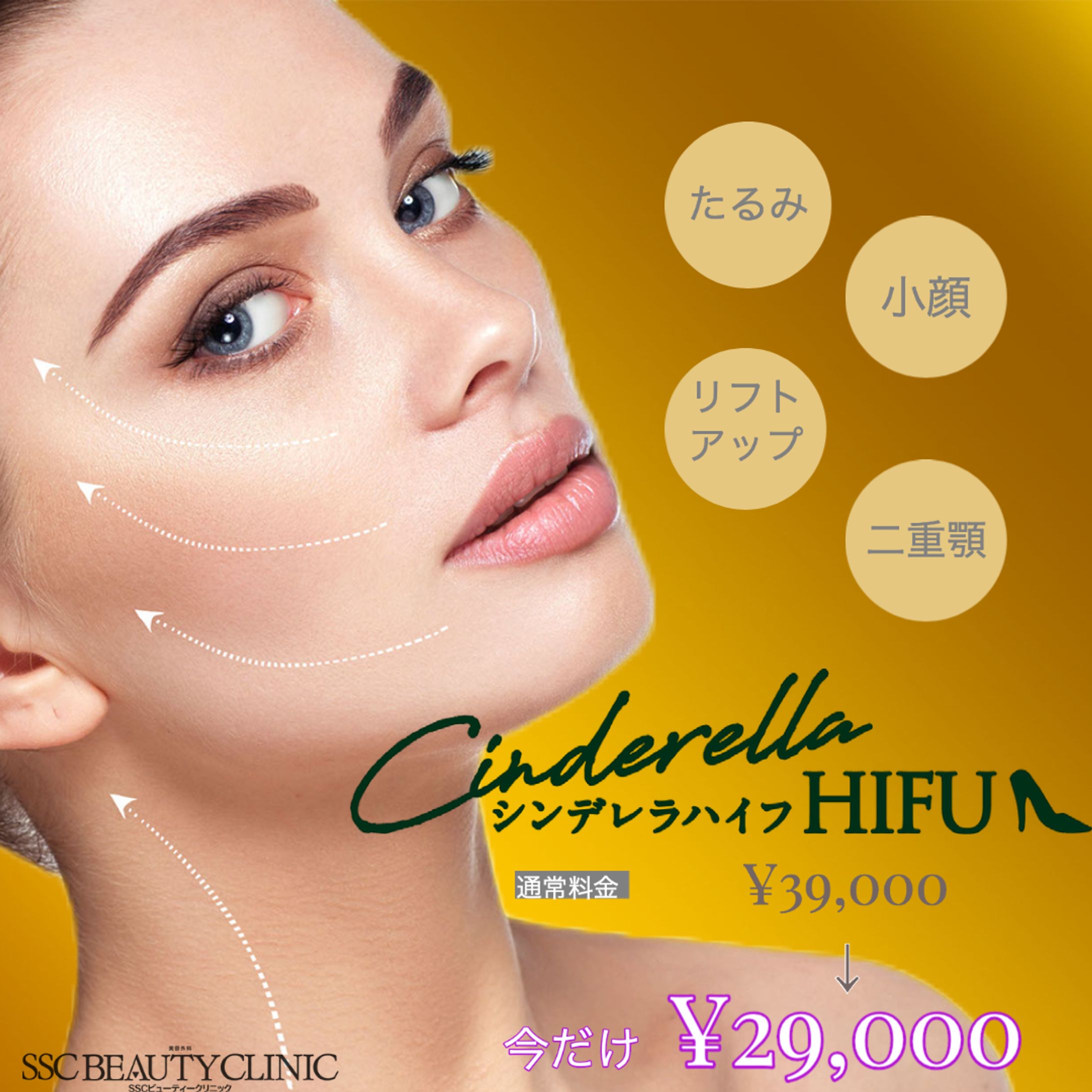 シンデレラHIFU投稿-1