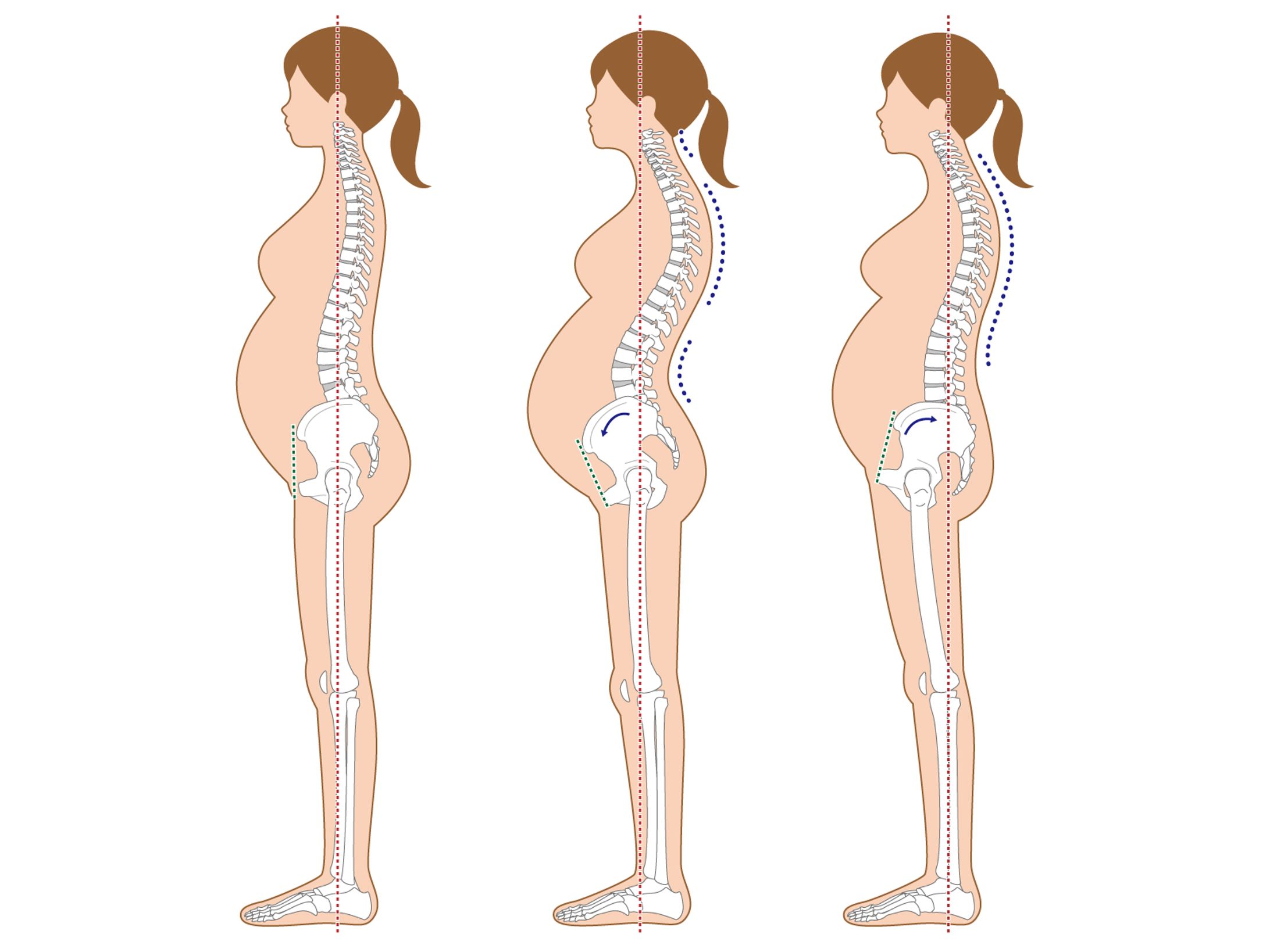 妊婦さんの姿勢（立位）-1