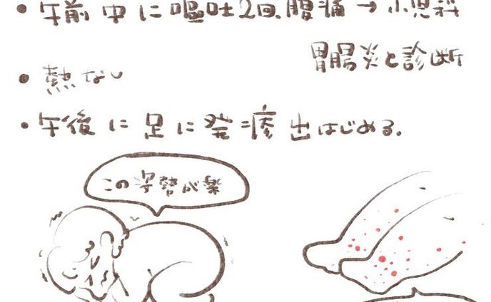 ----------♡----------

‪𝐃𝐚𝐲‬ 24 2023.05.23

嘔吐、腹痛で小児科
胃腸炎と診断されましたが
その時点で不信でした。

熱もない
下痢もしてない
嘔吐も胃腸炎の時とは違う感じだったし
経験値6年の母の感が違和感を覚えました。

午後からは足に発疹
口にもあるから
手足口病じゃないかな？と初めは思ってました。

長女が2歳の頃手足口病にかかった事があって
手には発疹無し
足、口に発疹だったので
似てるなぁと思い出しました。

#アレルギー性紫斑病  #iga血管炎  #入院  #2歳  #3歳  #病気  #小児科  #皮膚科 
 #100日チャレンジ  #育児日記  #1日1絵  #かわいい  #ゆるいイラスト #女の子ママ  #女の子  #日常#illustrations  #illustrate #cute  #girl  #일러스트 #데일리  #귀여워 #패션  #그림스타그램