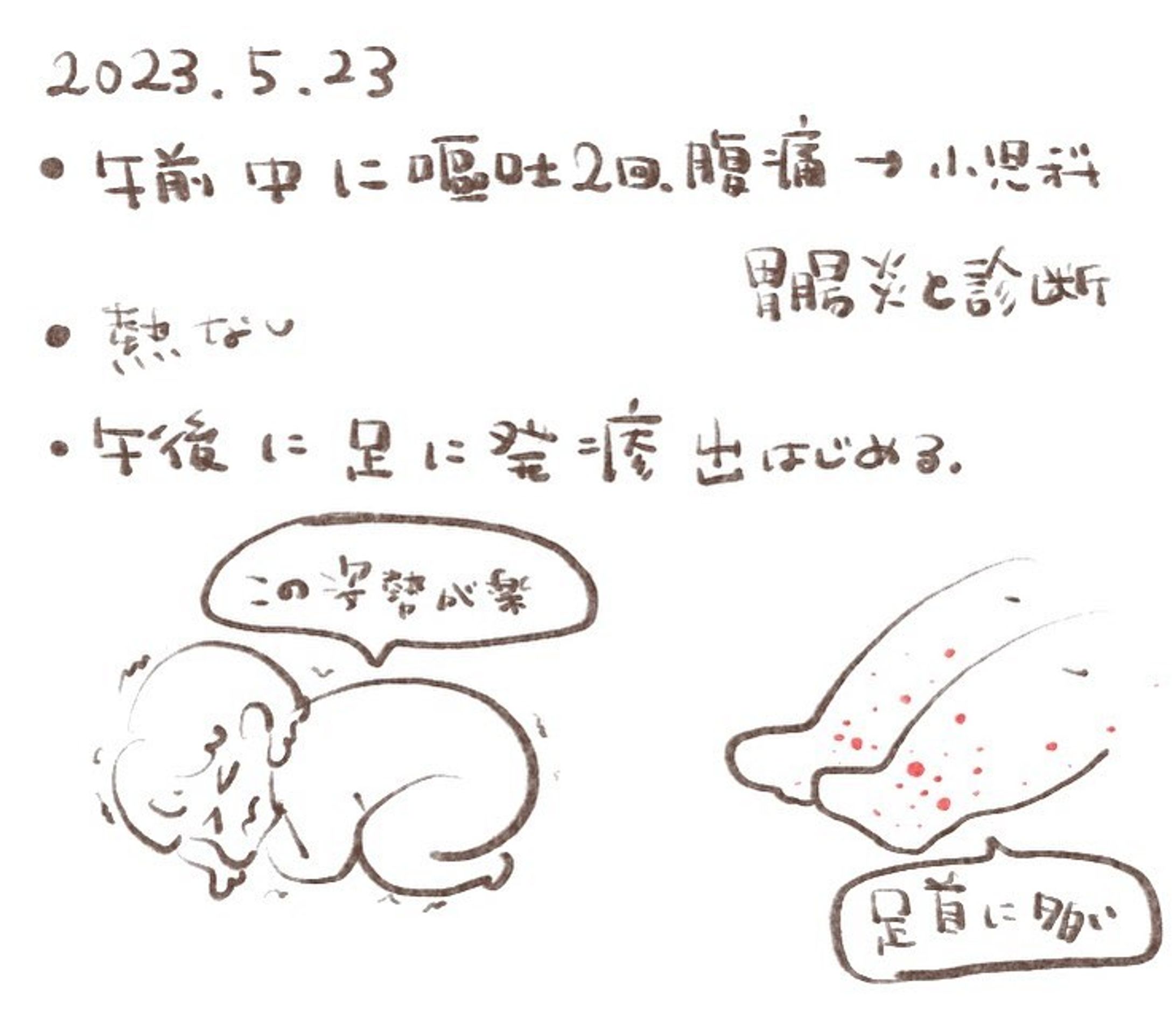 ----------♡----------

‪𝐃𝐚𝐲‬ 24 2023.05.23

嘔吐、腹痛で小児科
胃腸炎と診断されましたが
その時点で不信でした。

熱もない
下痢もしてない
嘔吐も胃腸炎の時とは違う感じだったし
経験値6年の母の感が違和感を覚えました。

午後からは足に発疹
口にもあるから
手足口病じゃないかな？と初めは思ってました。

長女が2歳の頃手足口病にかかった事があって
手には発疹無し
足、口に発疹だったので
似てるなぁと思い出しました。

#アレルギー性紫斑病  #iga血管炎  #入院  #2歳  #3歳  #病気  #小児科  #皮膚科 
 #100日チャレンジ  #育児日記  #1日1絵  #かわいい  #ゆるいイラスト #女の子ママ  #女の子  #日常#illustrations  #illustrate #cute  #girl  #일러스트 #데일리  #귀여워 #패션  #그림스타그램-1