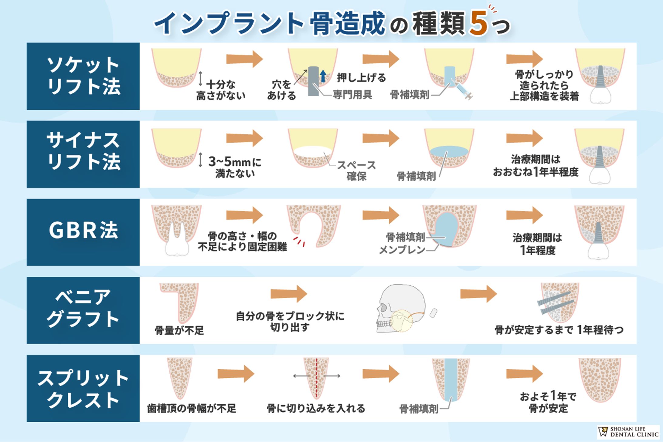 インプラント説明画像-1