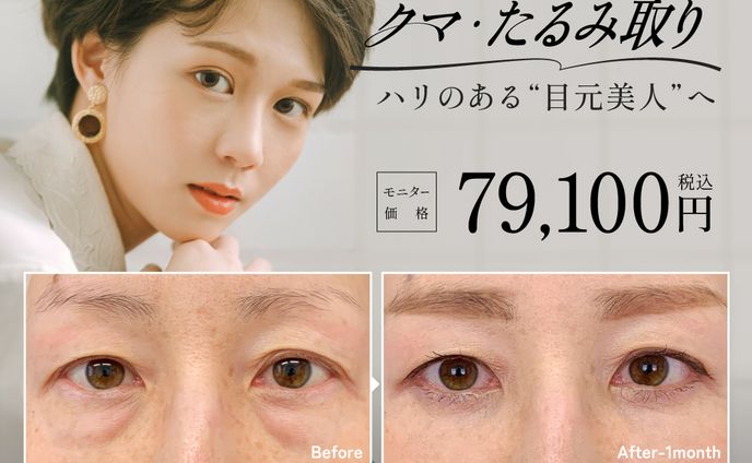 宣伝画像、リッチメッセージ