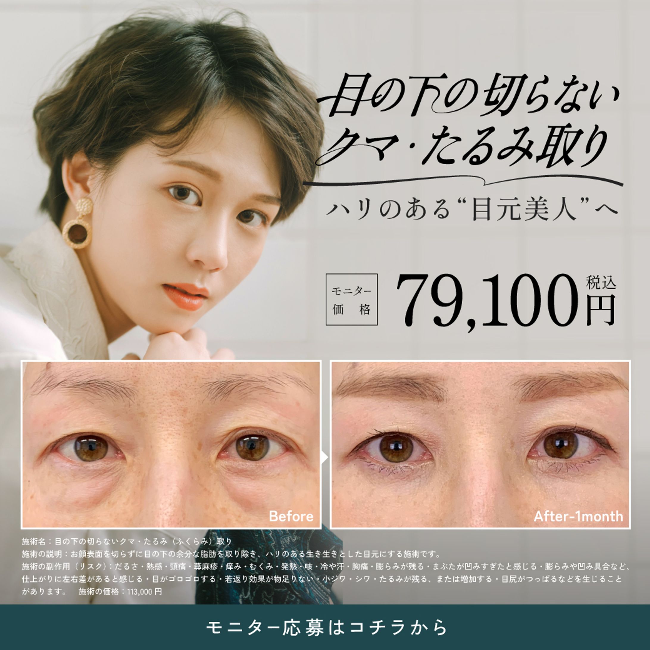 LINE リッチメッセージ-1