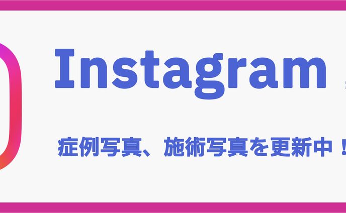インスタグラムバナー
