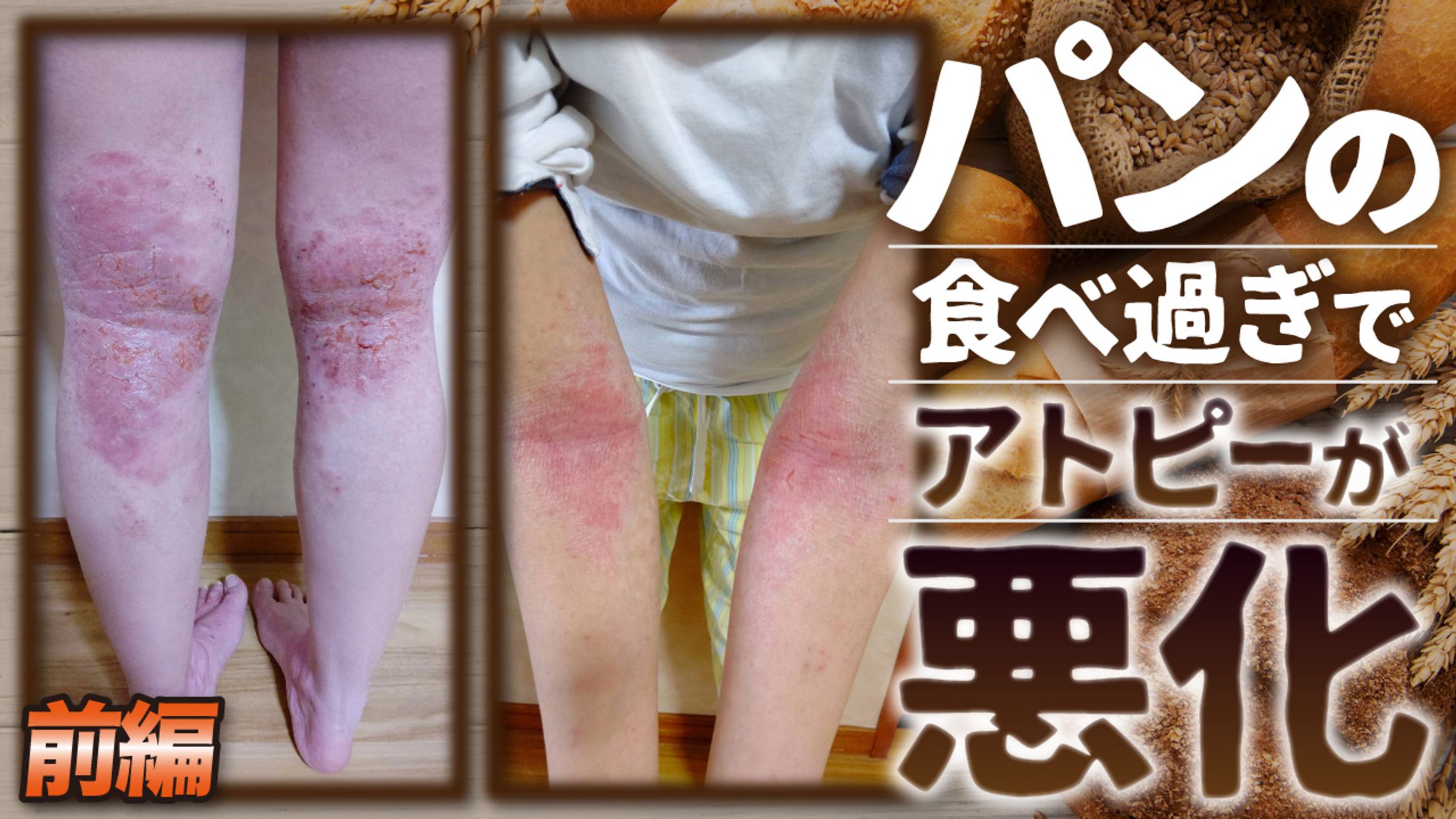 【実績】You Tubeサムネイル-1