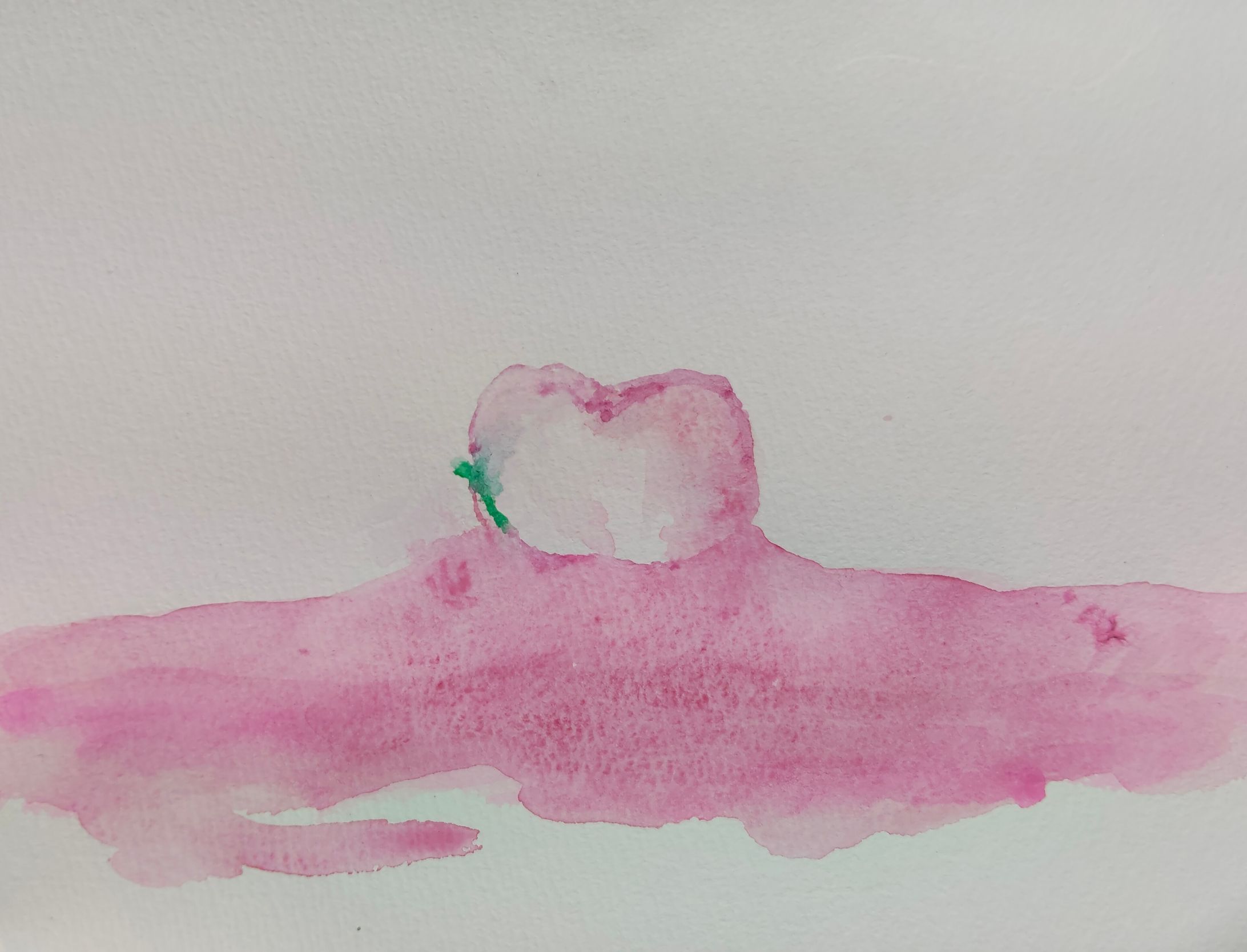 歯-1