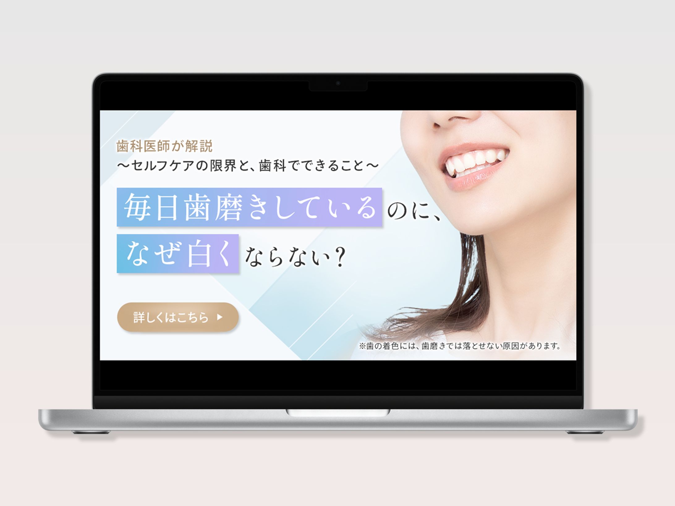 歯科医院コラム記事訴求バナー-1