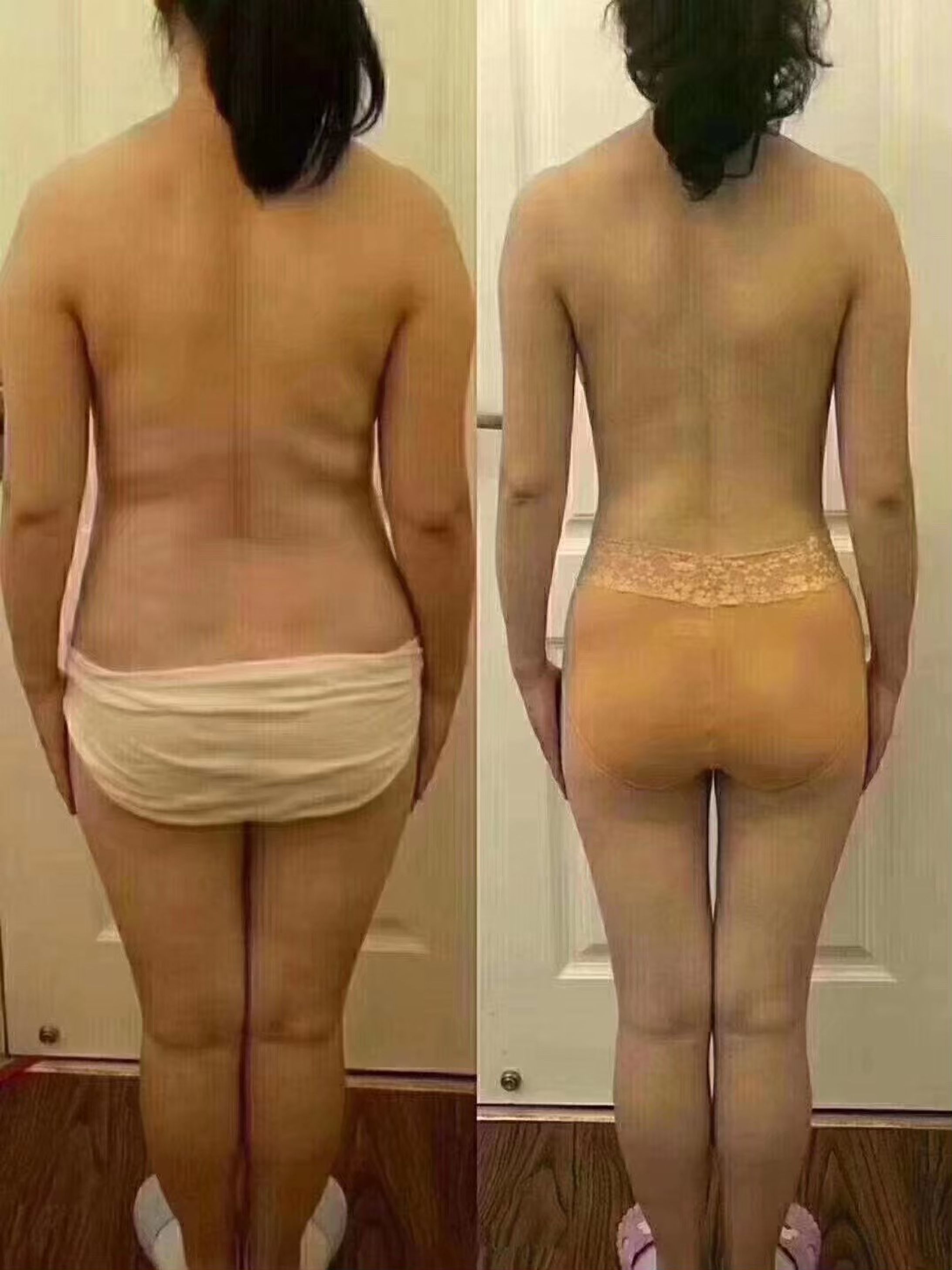 【女性】劇的ビフォーアフター-1