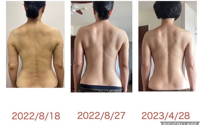 【女性】劇的ビフォーアフター