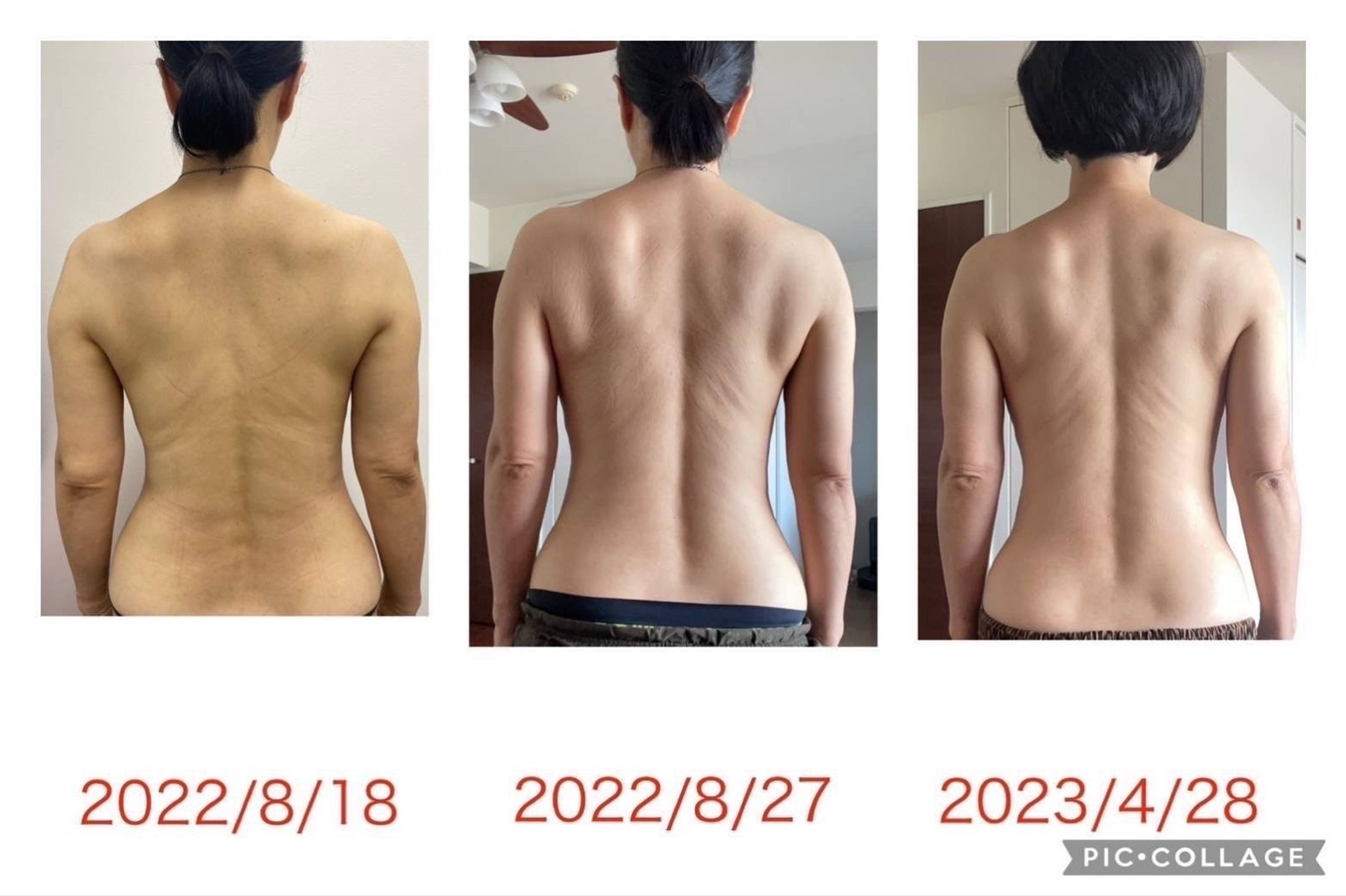 【女性】劇的ビフォーアフター-1