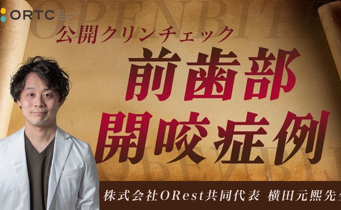 サムネ