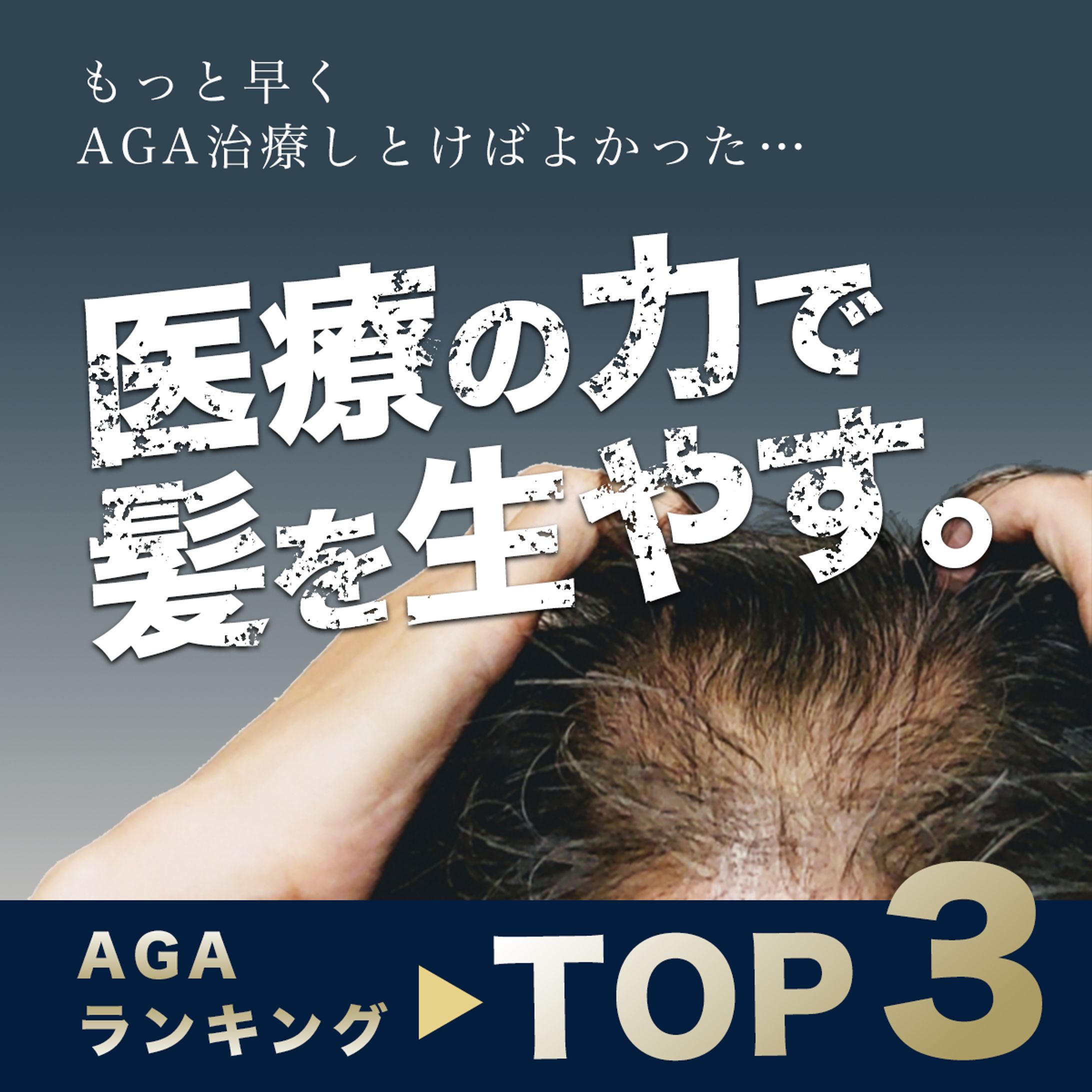 AGA治療ランキング　広告バナー-1