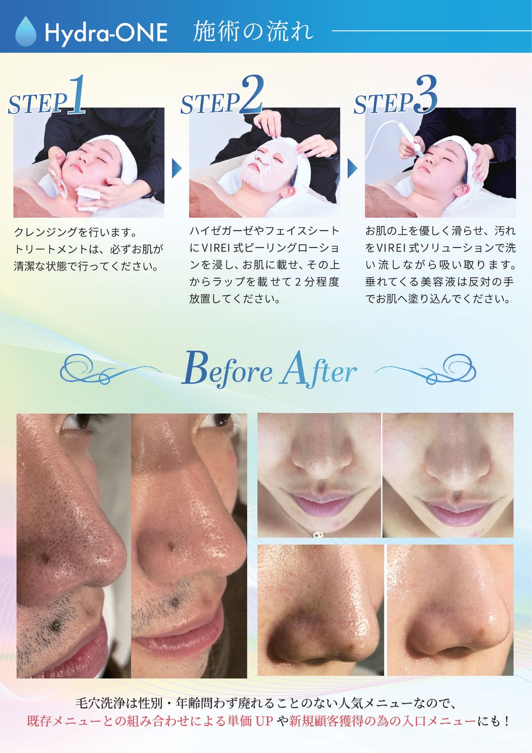 VIREI stAyle.ハイドラワンソリューション、ピーリング VIREI stAyle.ハイドラワンソリューション、ピーリング