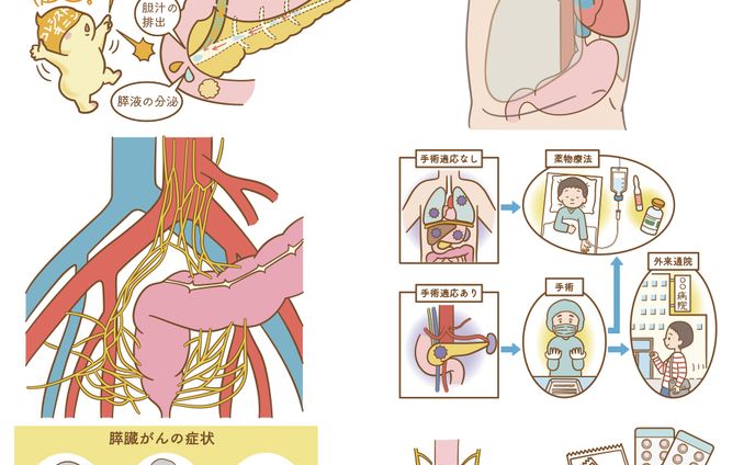 看護、ポケモン