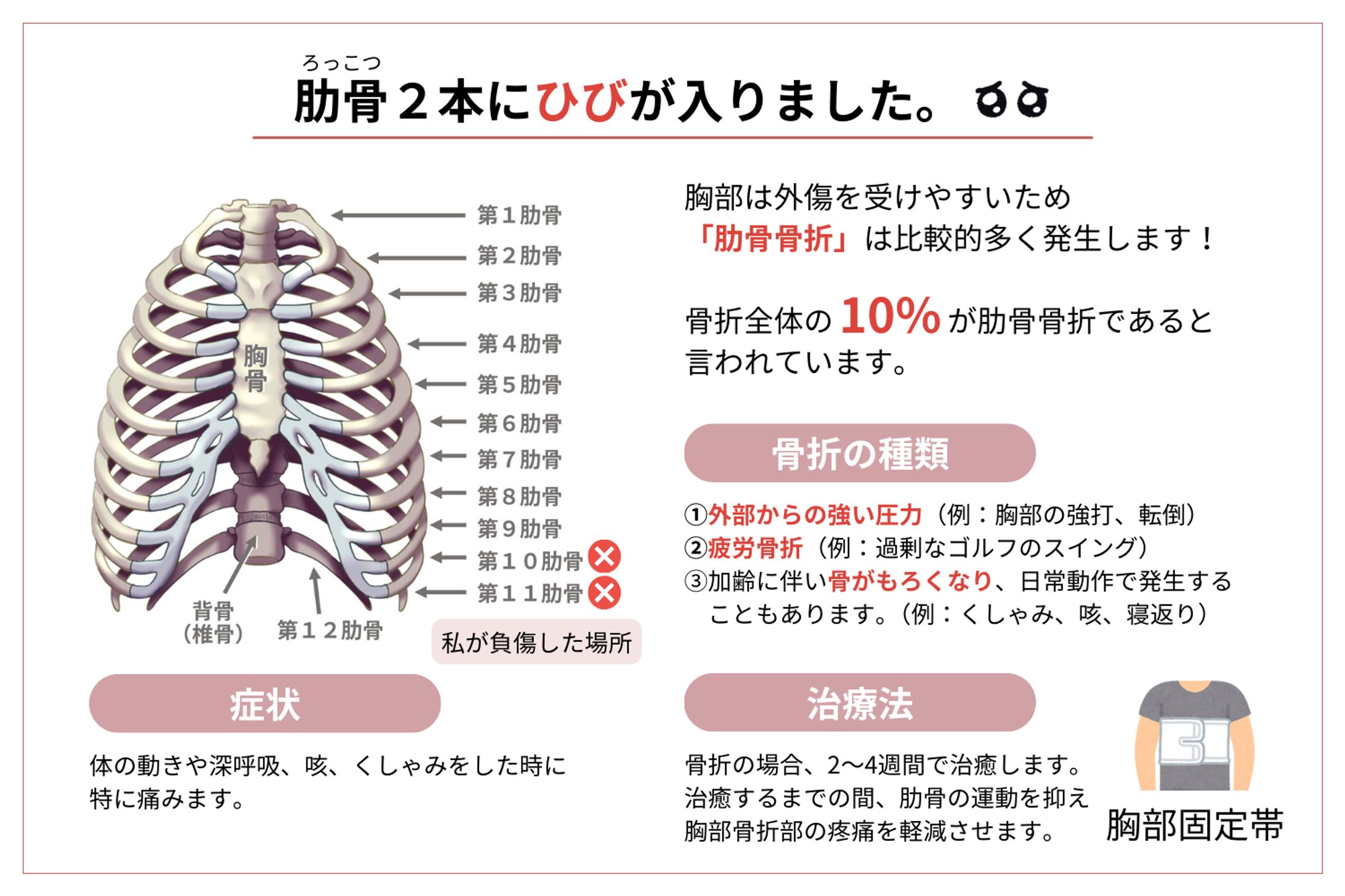 図解】肋骨骨折について