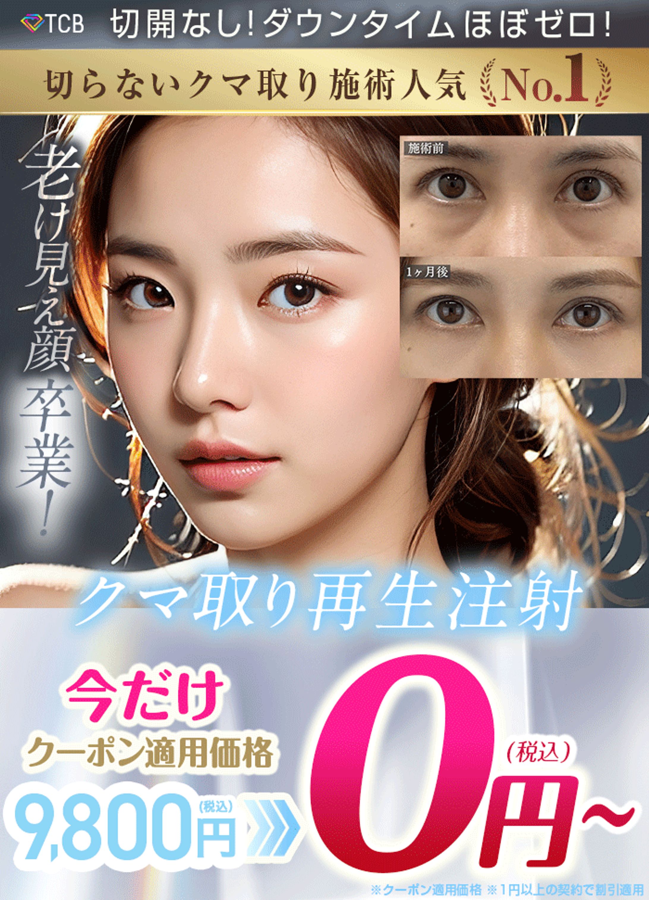 リード-1