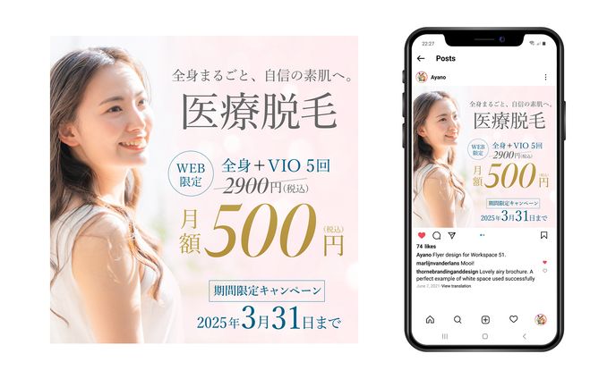 医療脱毛のバナー