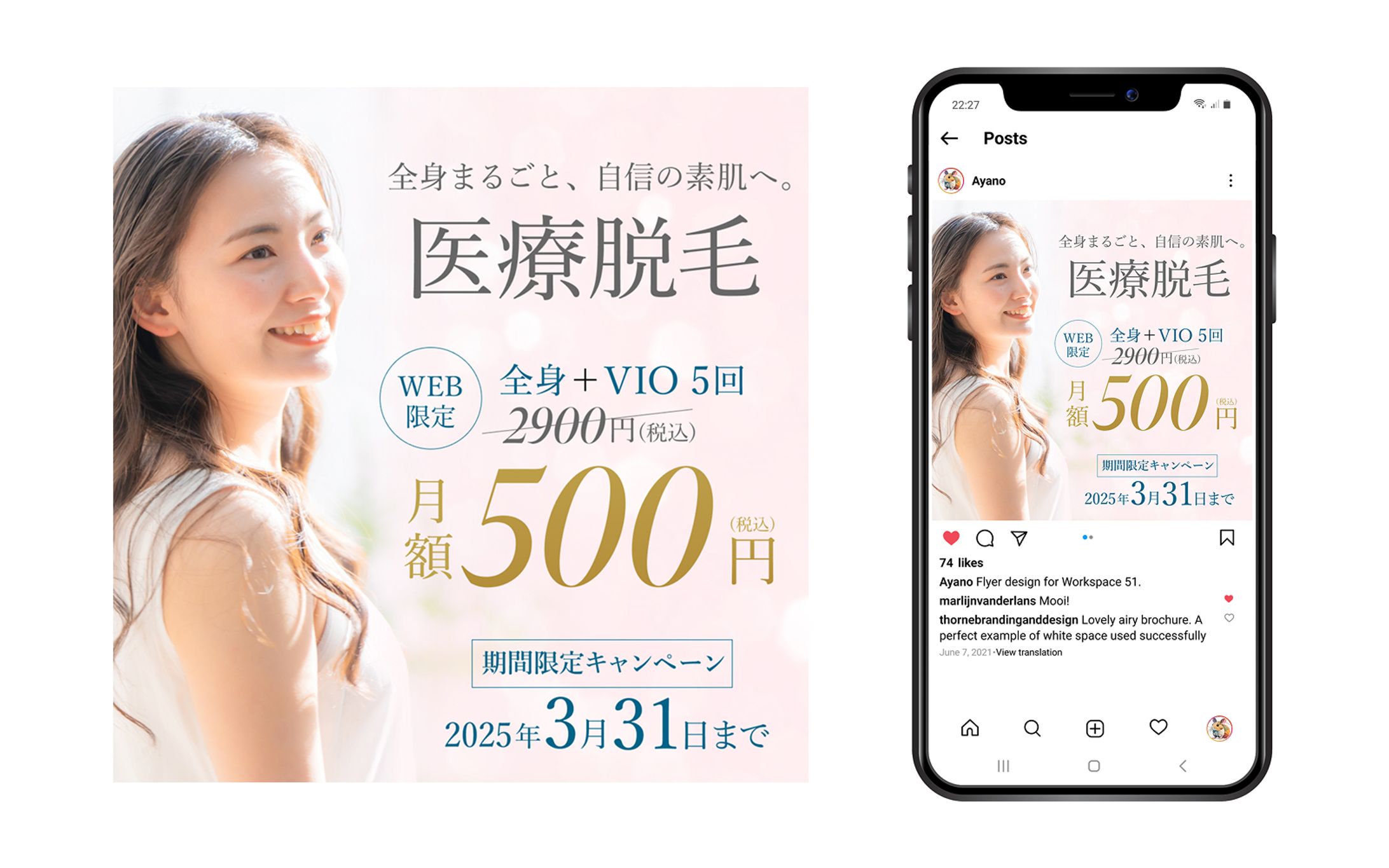 医療脱毛のバナー-1