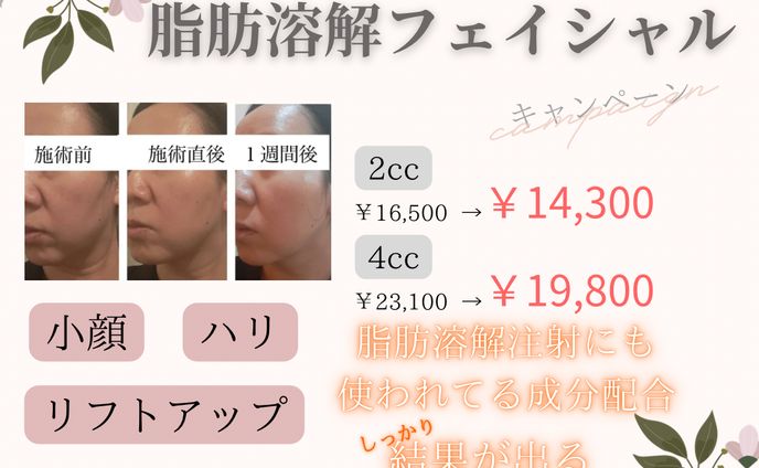 キャンペーン画像