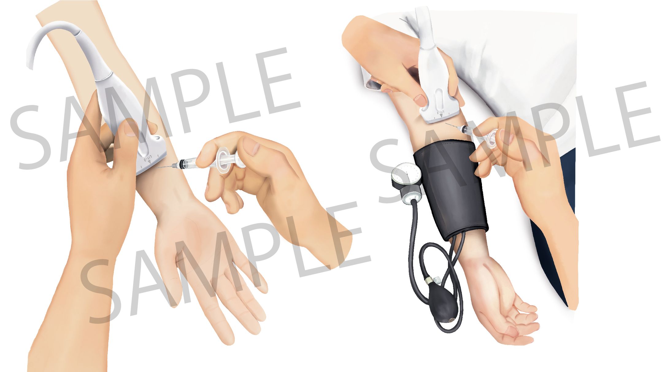 クリニック施術説明用イラスト-1