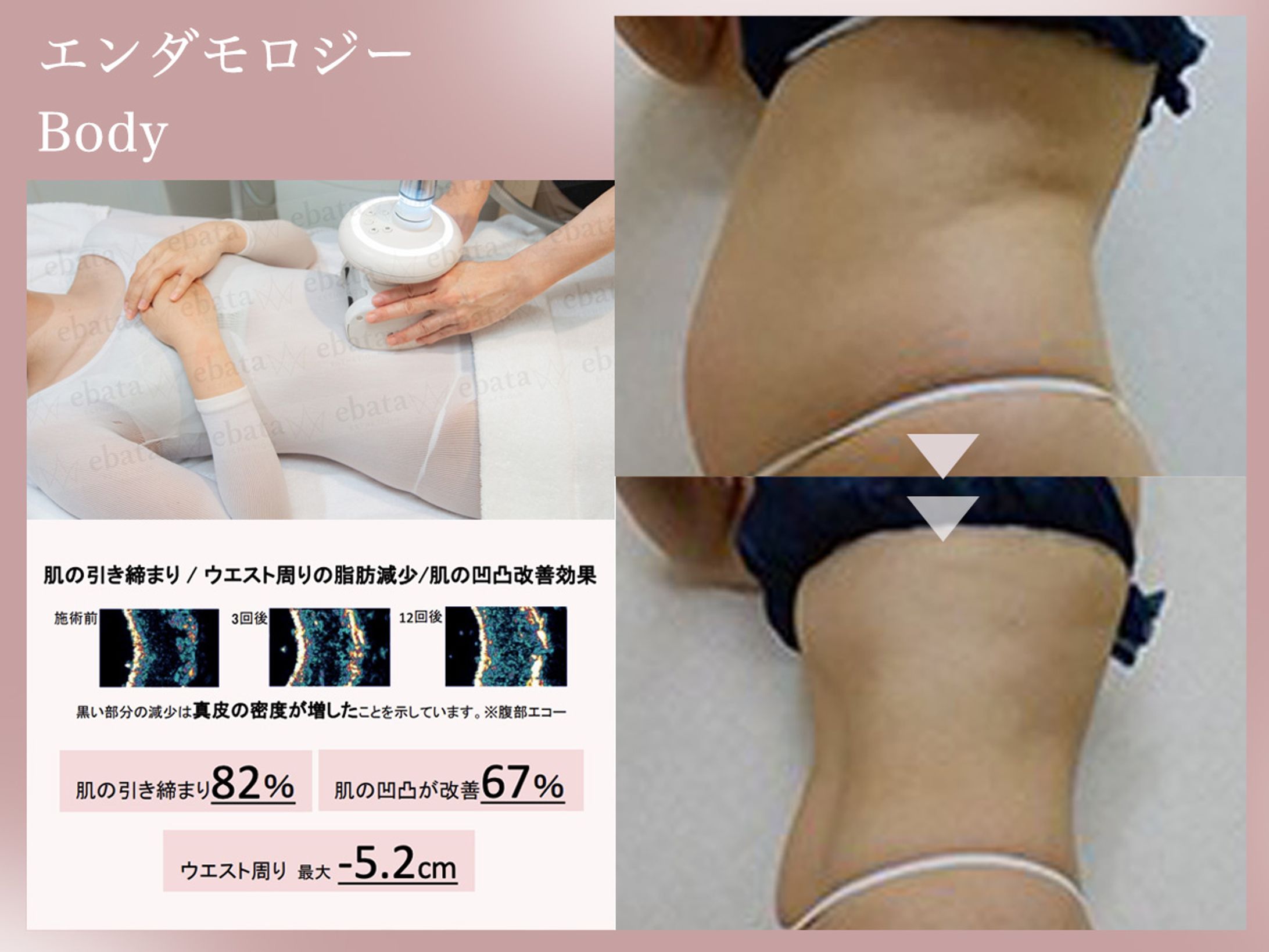 株式会社 kannonbeauty様　Hotpepperbeauty掲載画像-1