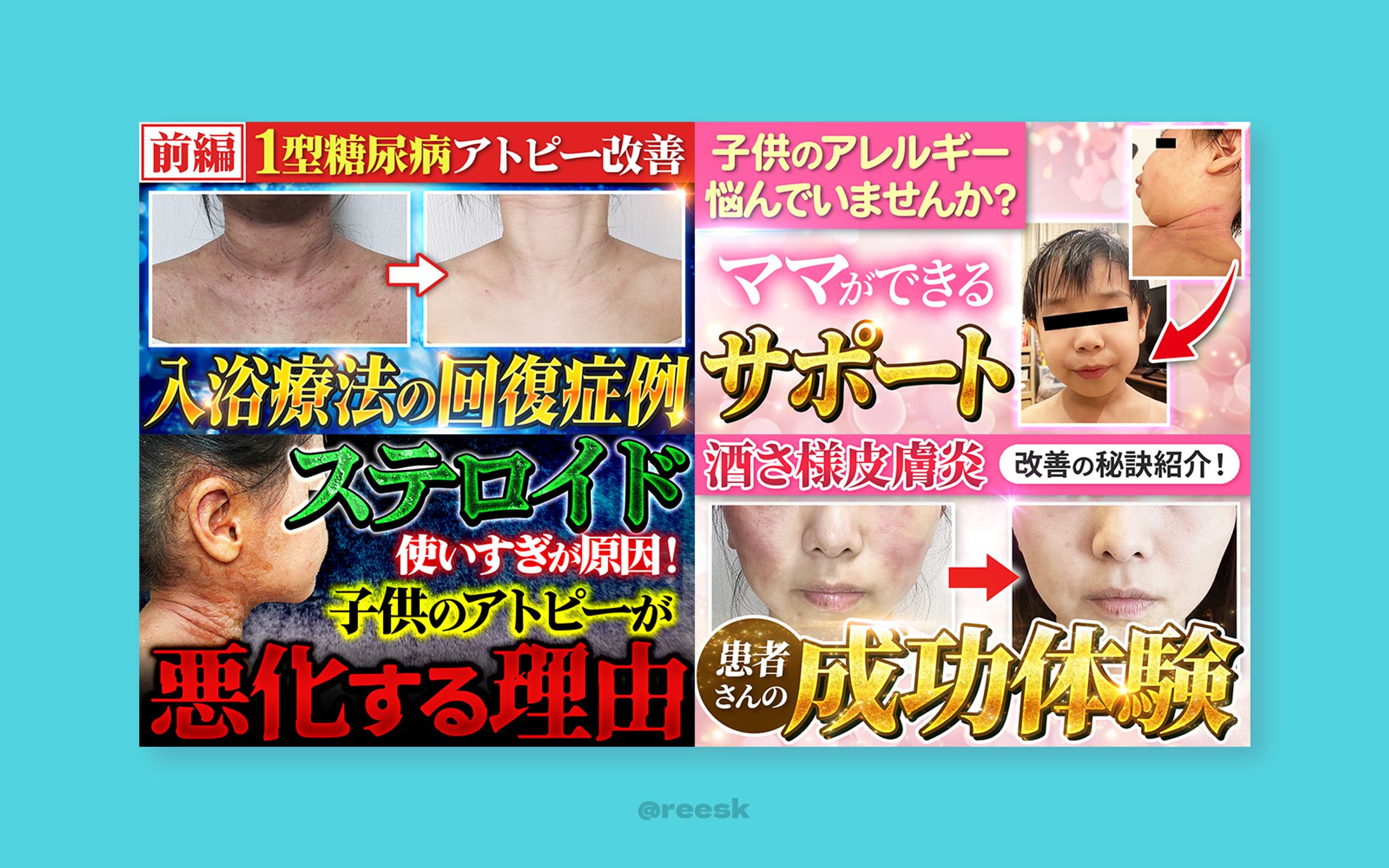 【実績】YouTubeサムネイル-1