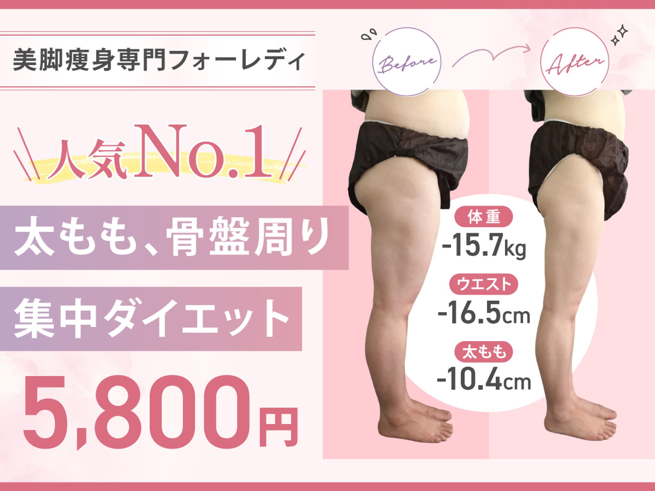 ホットペッパービューティートップ画像/エステ-1