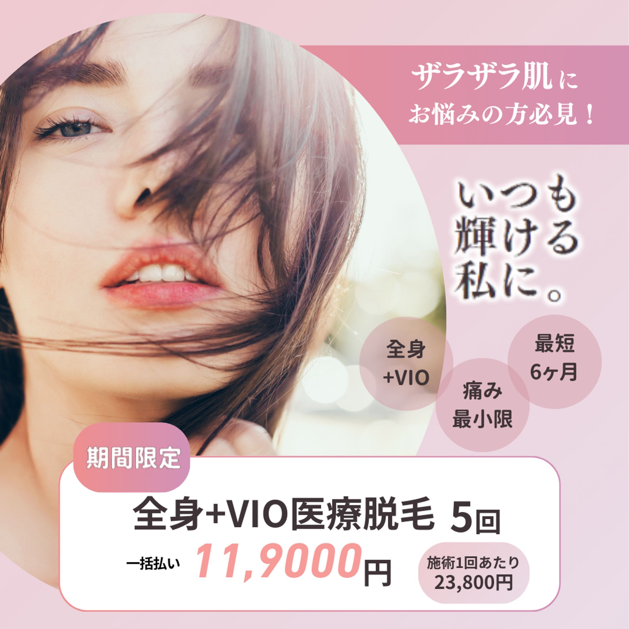 脱毛バナー-1