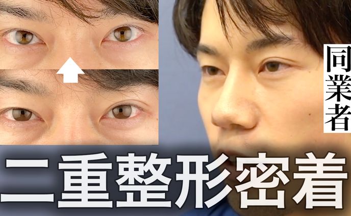 【サムネイル】美容整形