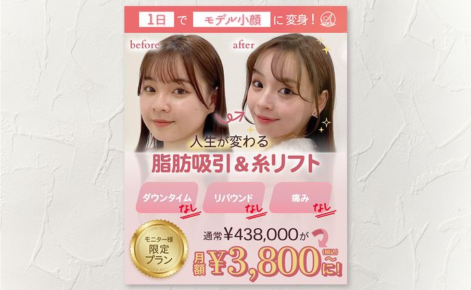 美容整形クリニックの広告バナー