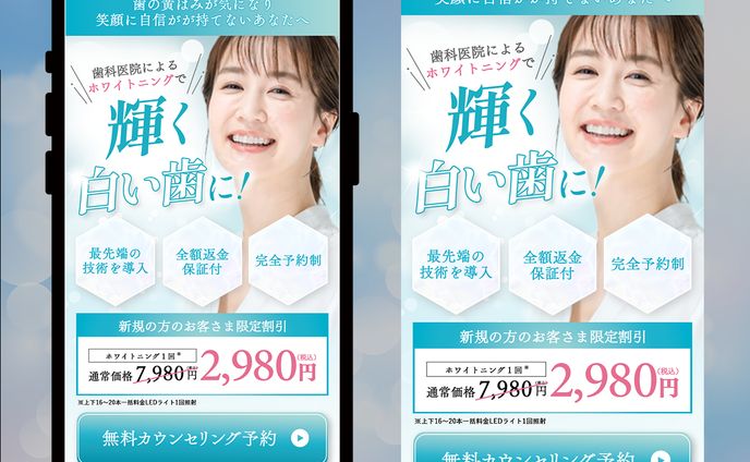 【FV】ホワイトニング