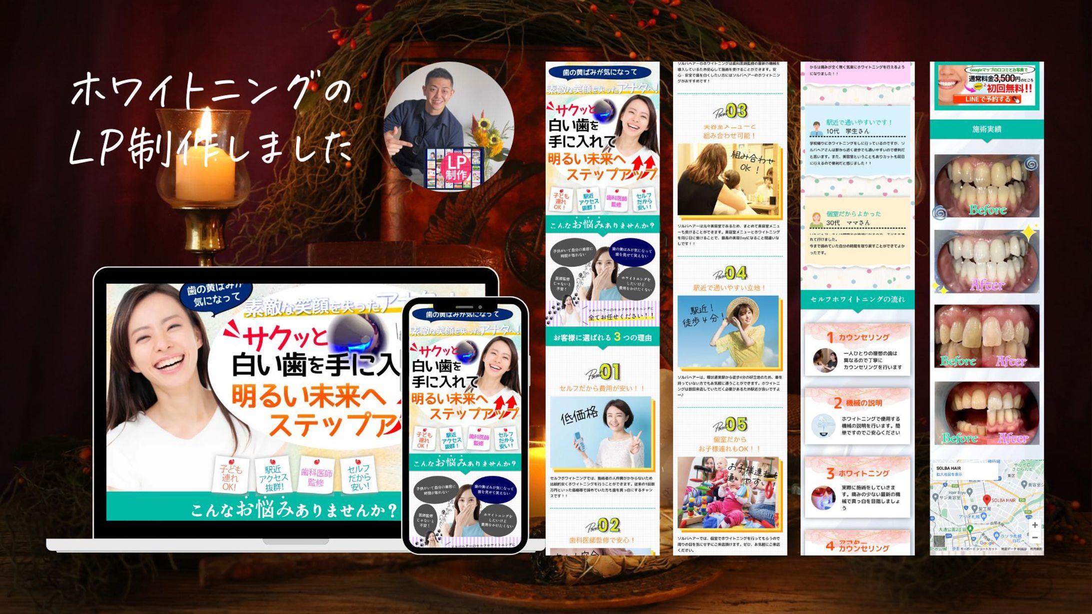 ホワイトニングサロン様のLPを制作しました-1