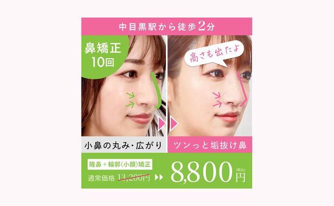 広告バナー